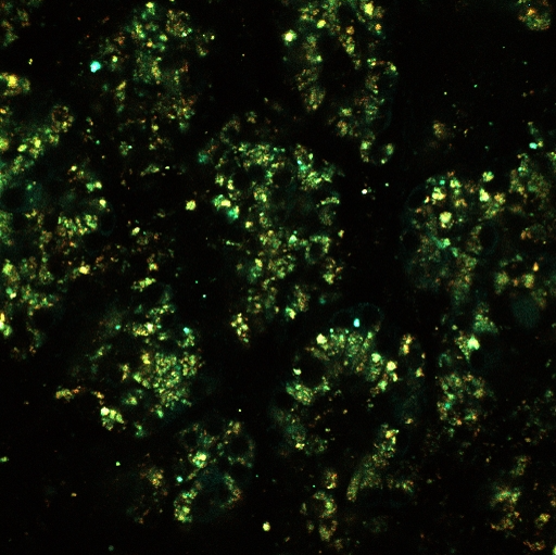 В НМИЦ эндокринологии создали уникальное устройство для безопасной хирургии В НМИЦ эндокринологии создали уникальное устройство для безопасной хирургии